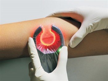 Venų ieškiklis "Veinspy", 1 vnt. - Image 4