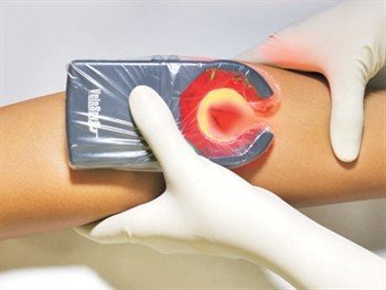 Venų ieškiklis "Veinspy", 1 vnt. - Image 5