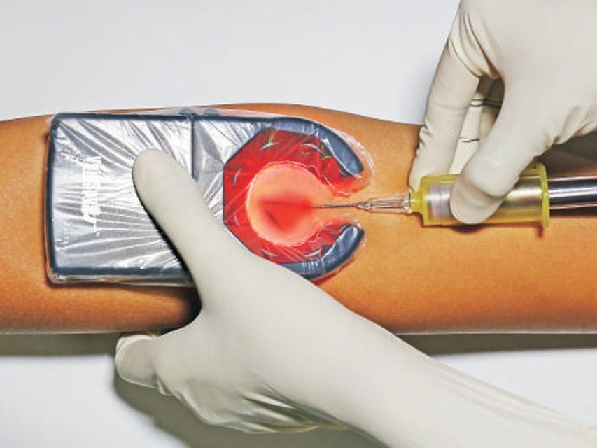 Venų ieškiklis "Veinspy", 1 vnt. - Image 6